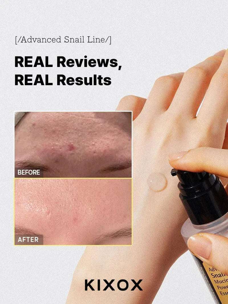 Snail Mucin 96% Power Repairing Essence 100ml
