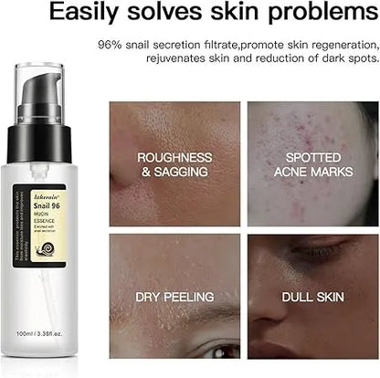 Snail Mucin 96% Power Repairing Essence 100ml