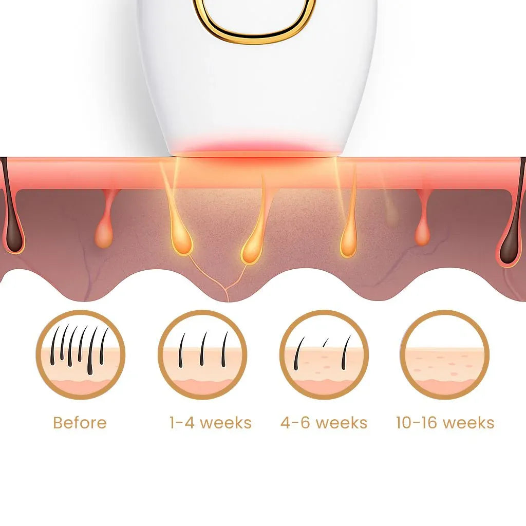 Painless IPL Laser Hair removal Handset