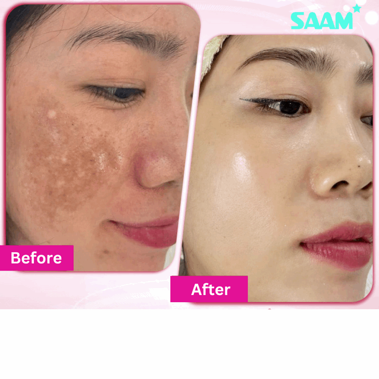 Saam renewal face cream.